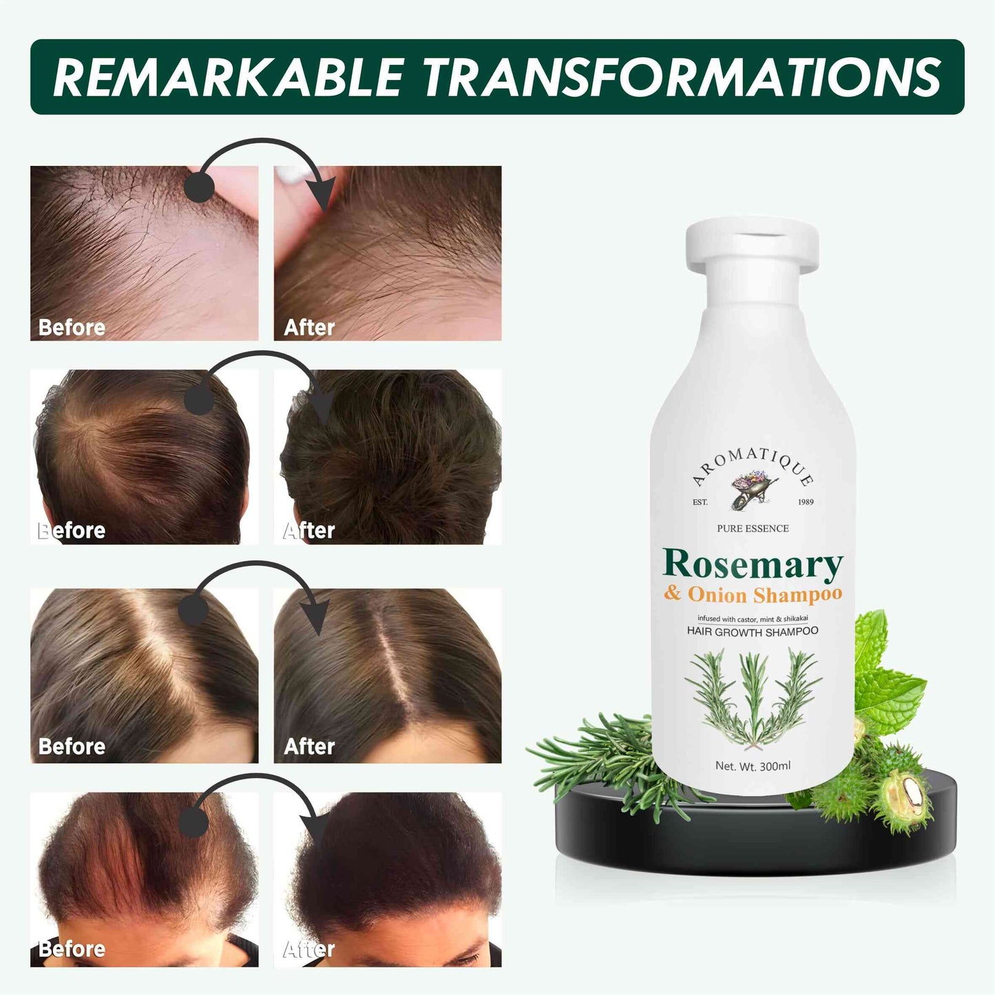 Rosemary & Onion Shampoo | 300ml