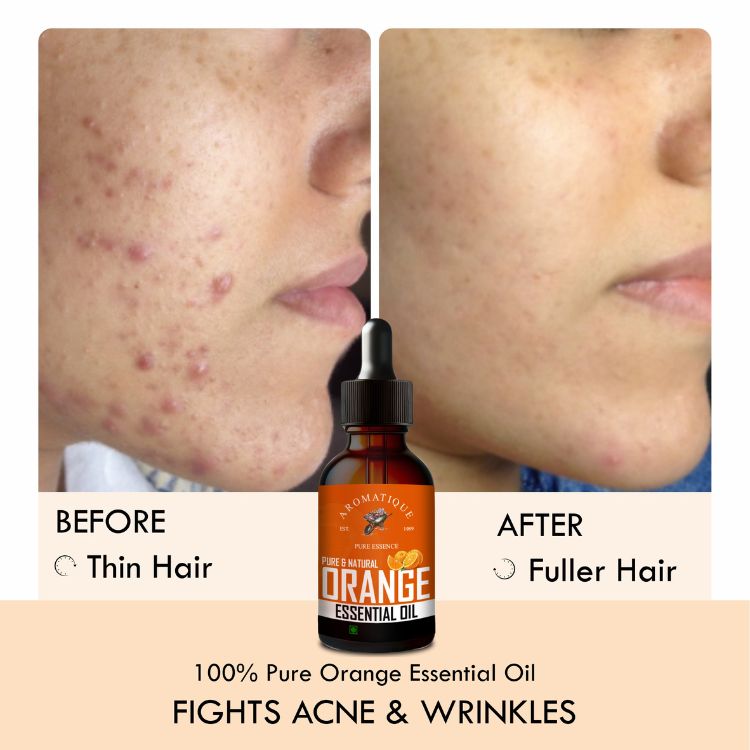 Sweet Orange Oil for Face, Scalp & Skin