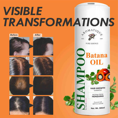 Batana Shampoo for Hair Growth | 300ml